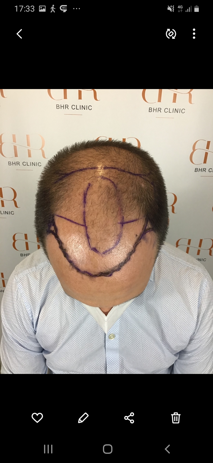 /foren/transplant/index.php/fa/56515/0/