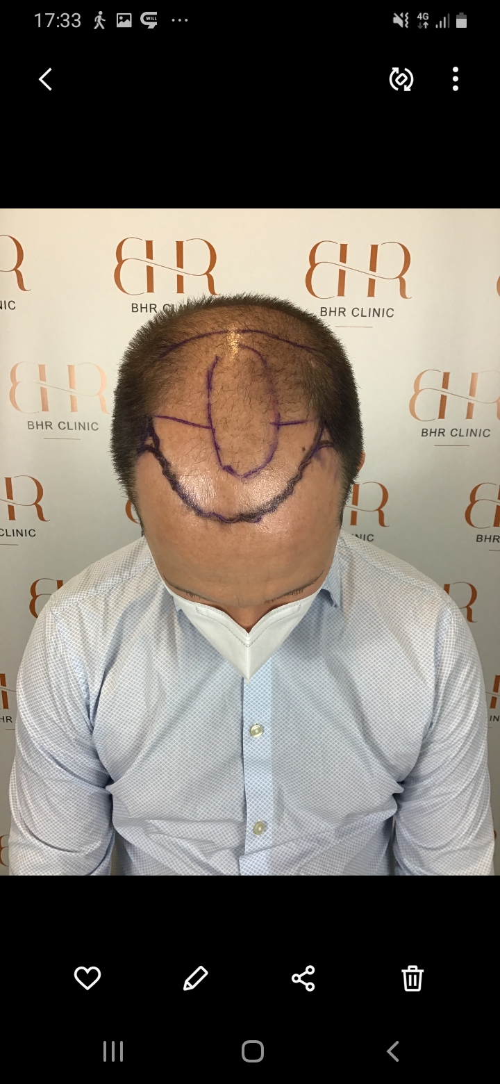 /foren/transplant/index.php/fa/56516/0/