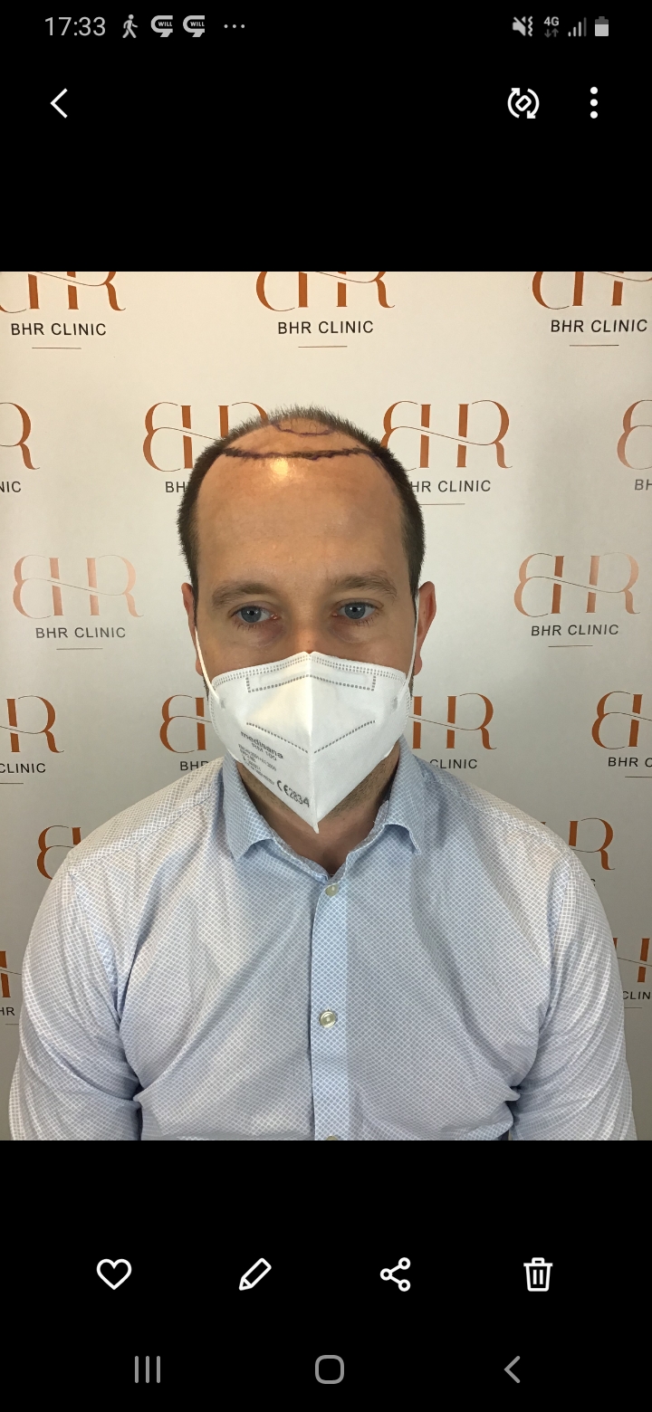 /foren/transplant/index.php/fa/56517/0/