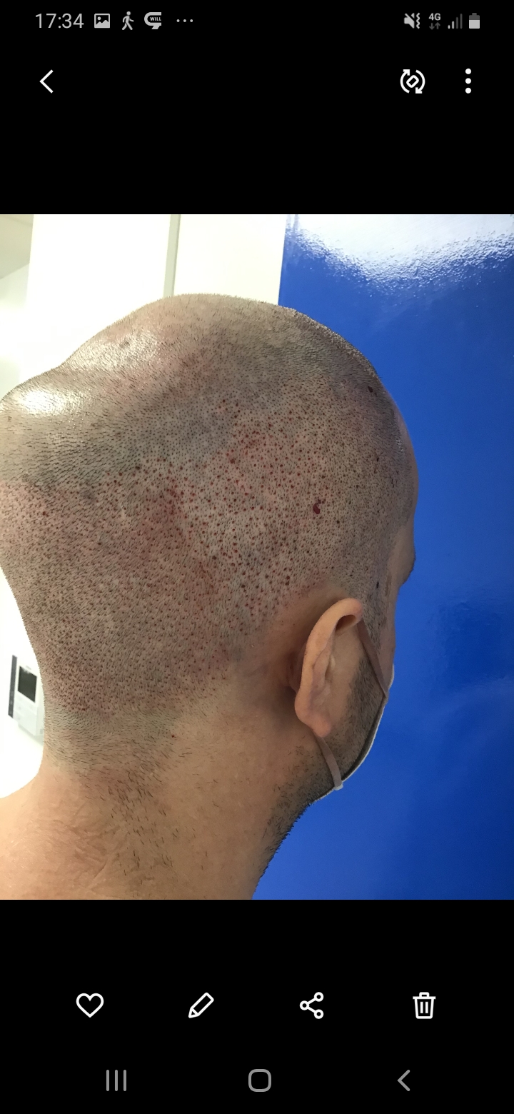 /foren/transplant/index.php/fa/56518/0/