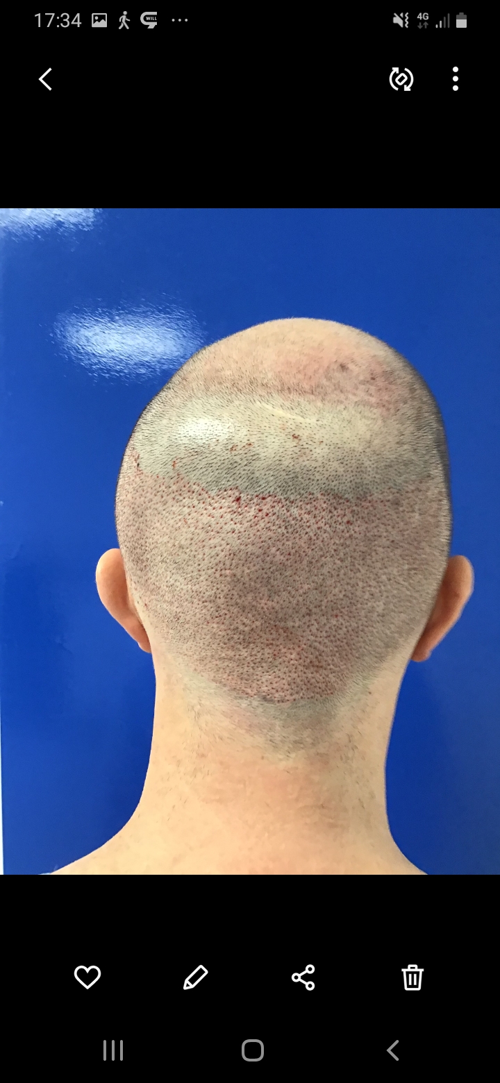 /foren/transplant/index.php/fa/56519/0/