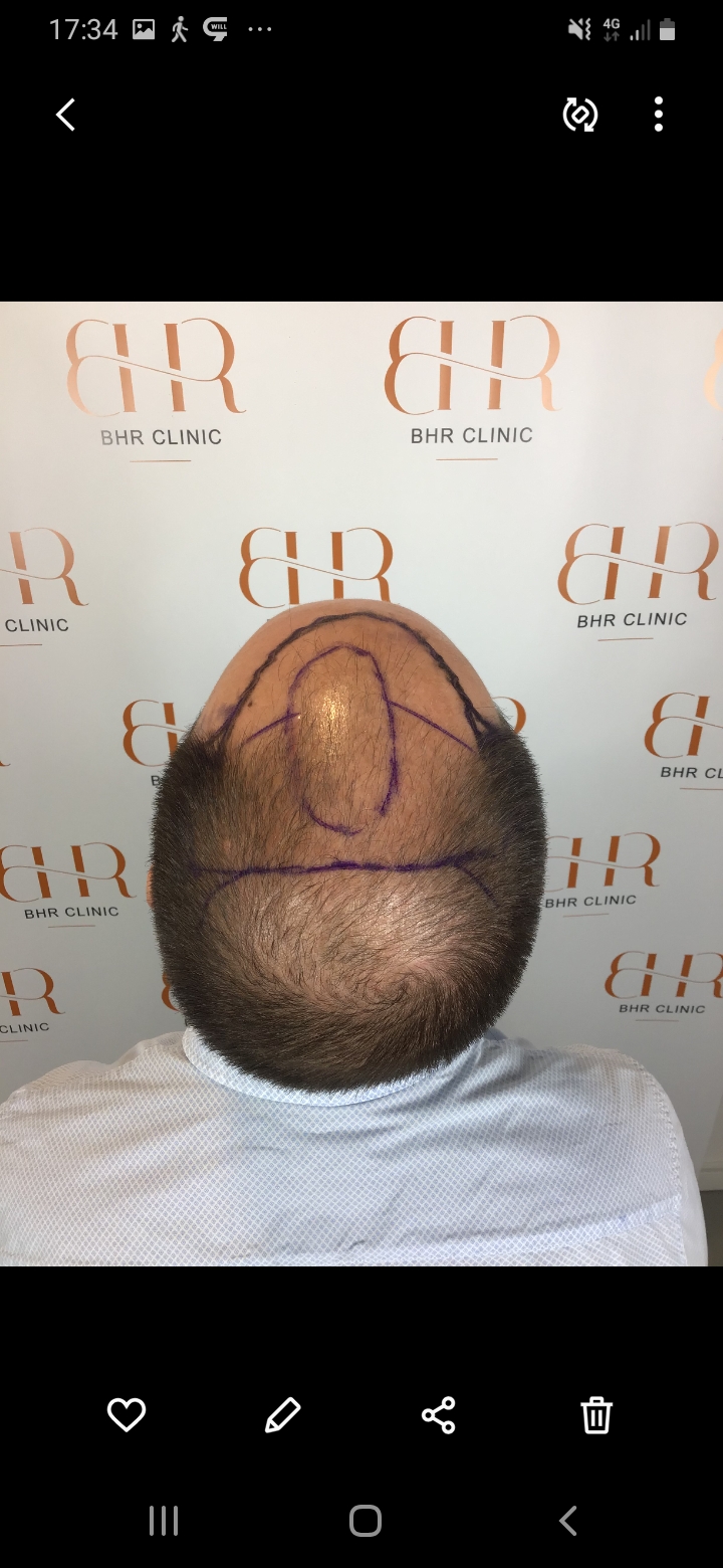 /foren/transplant/index.php/fa/56521/0/