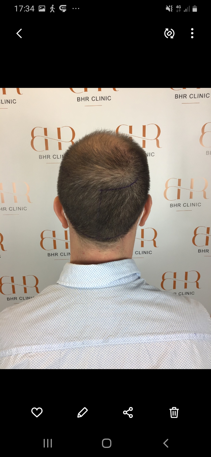 /foren/transplant/index.php/fa/56522/0/