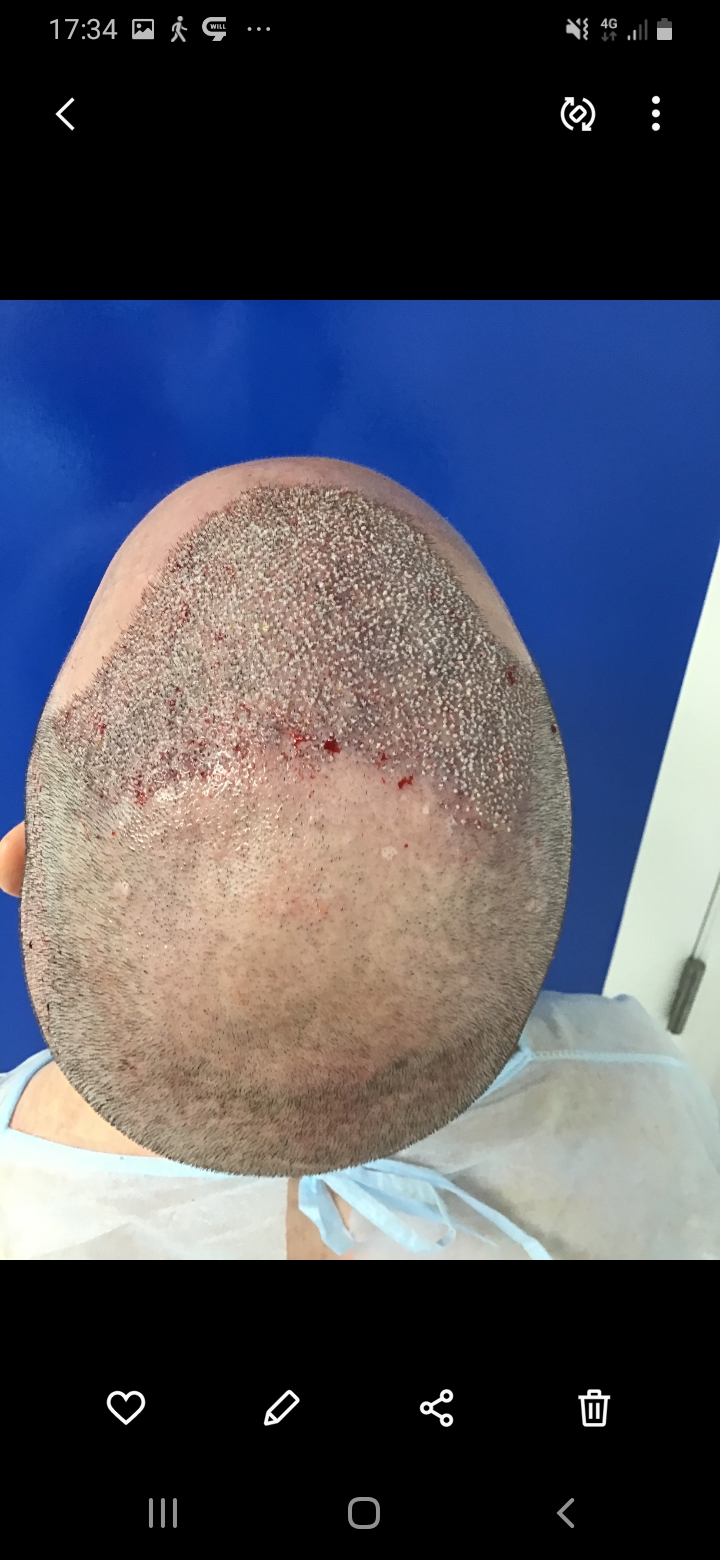 /foren/transplant/index.php/fa/56523/0/