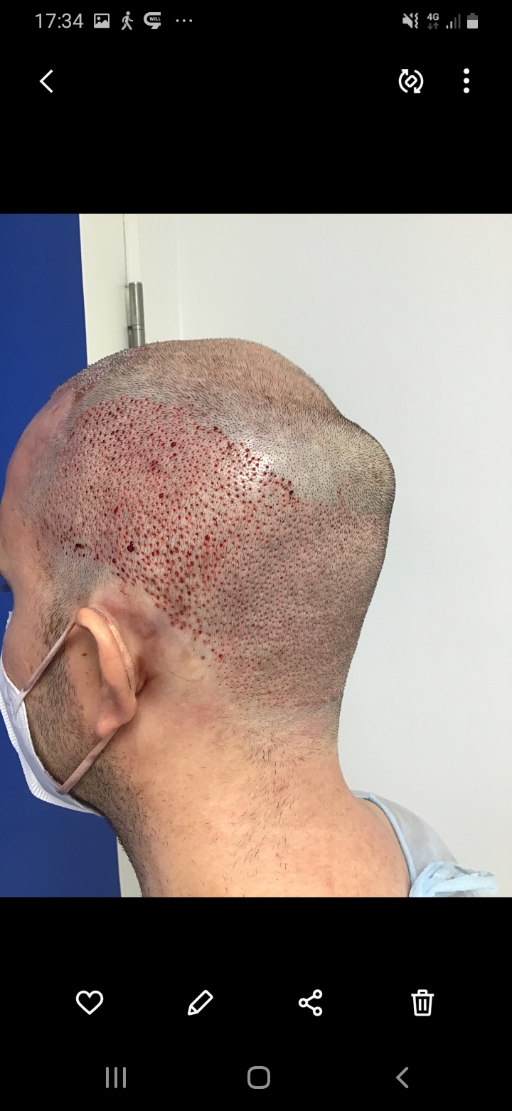 /foren/transplant/index.php/fa/56524/0/