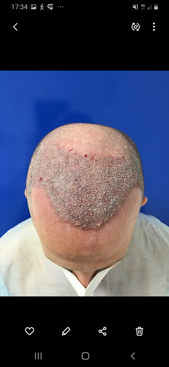 /foren/transplant/index.php/fa/56526/0/