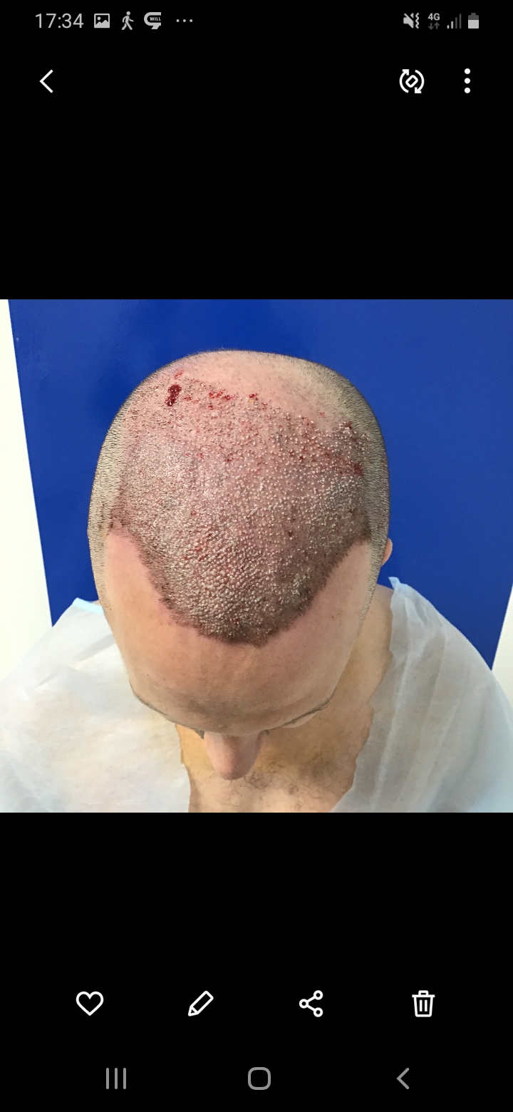 /foren/transplant/index.php/fa/56527/0/