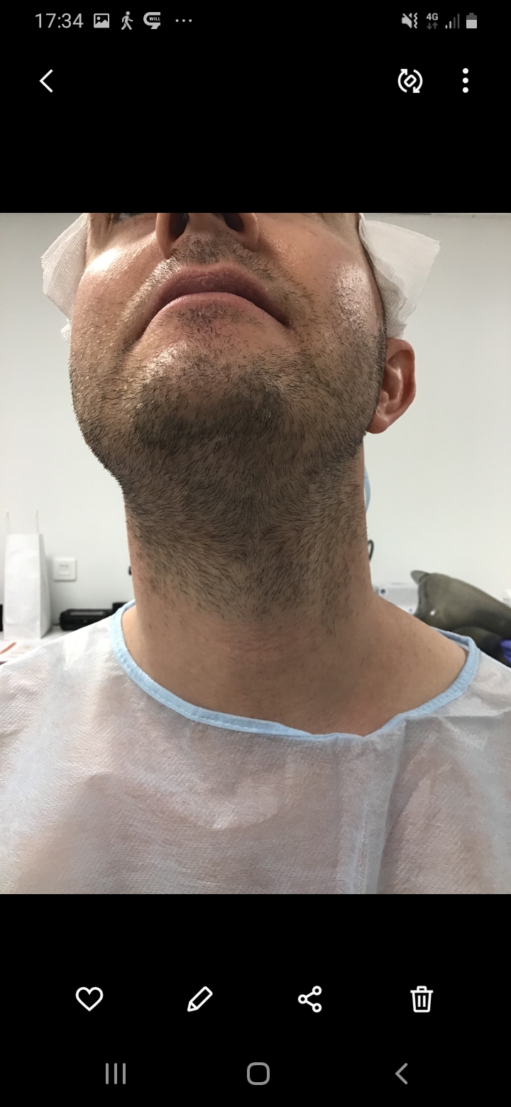 /foren/transplant/index.php/fa/56529/0/