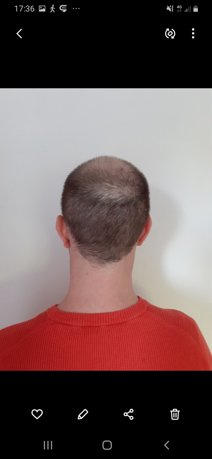 /foren/transplant/index.php/fa/56530/0/