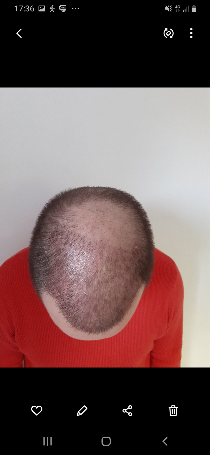 /foren/transplant/index.php/fa/56531/0/