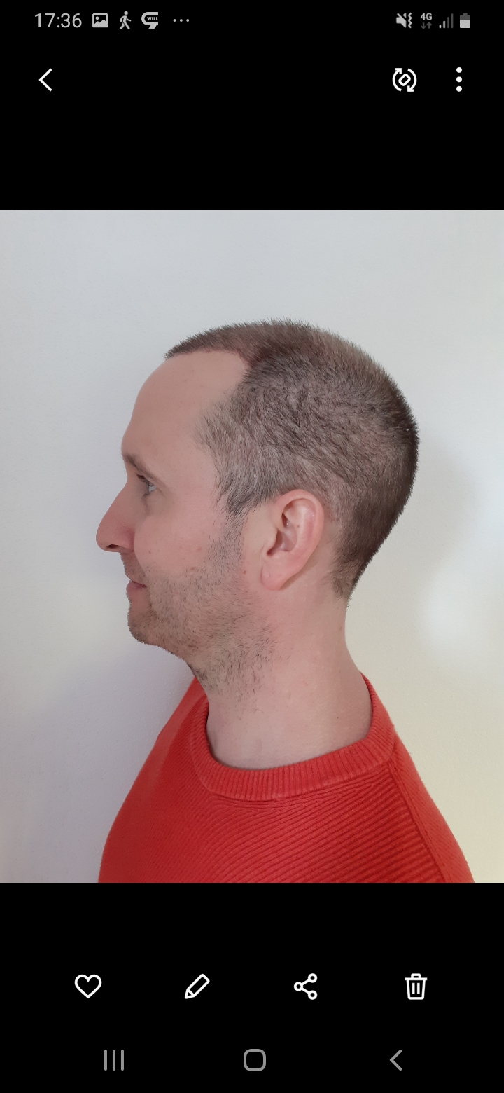 /foren/transplant/index.php/fa/56532/0/