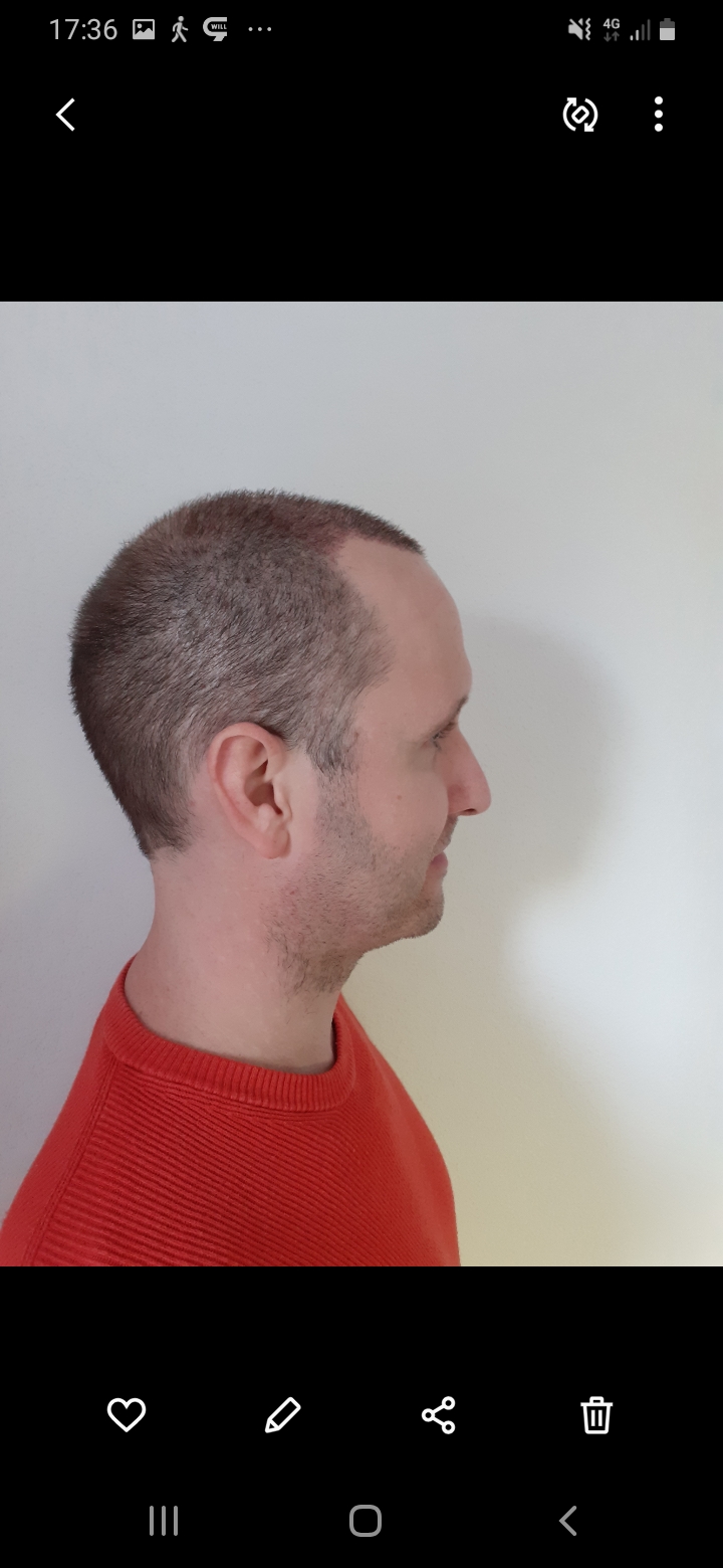 /foren/transplant/index.php/fa/56533/0/