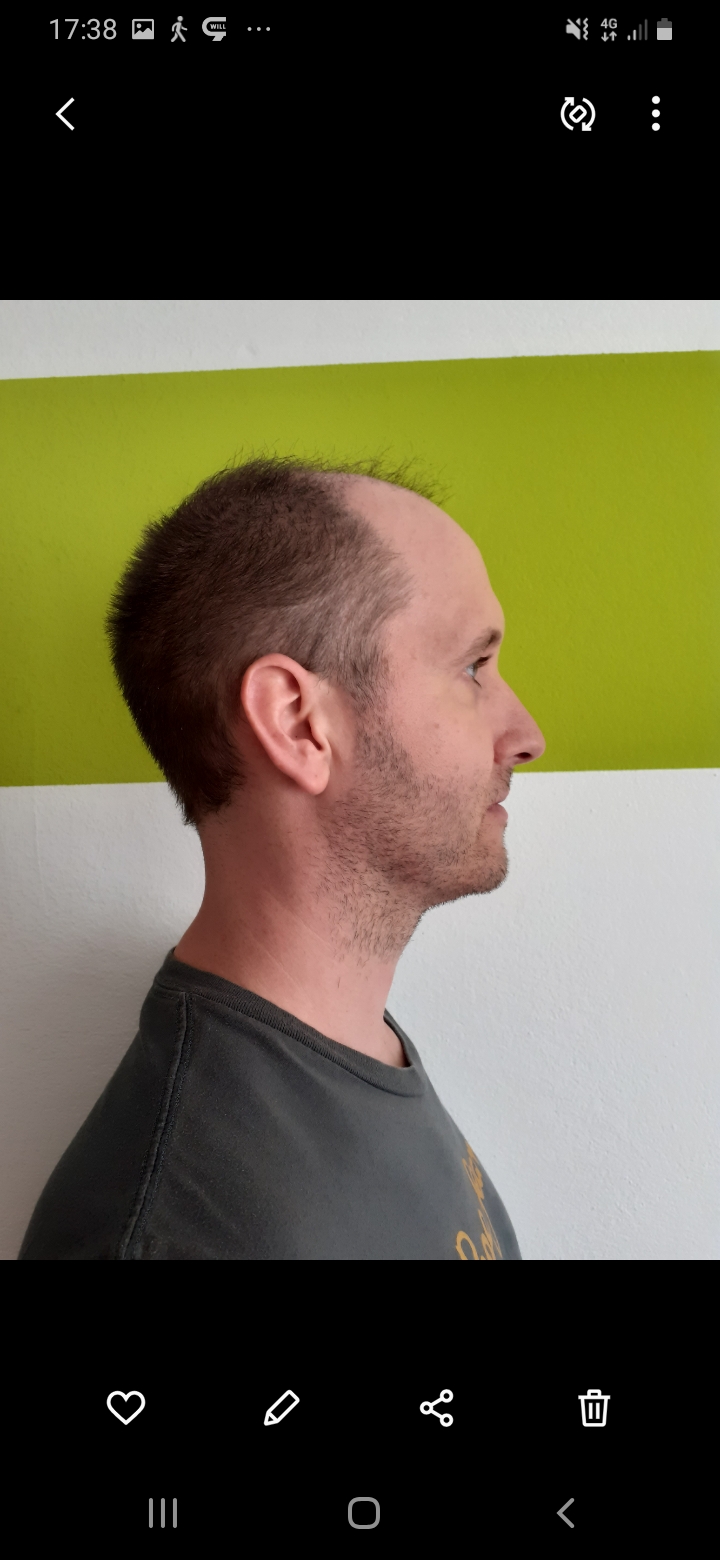 /foren/transplant/index.php/fa/56536/0/