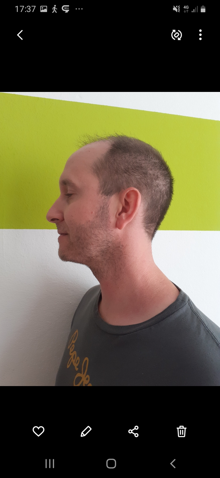 /foren/transplant/index.php/fa/56537/0/