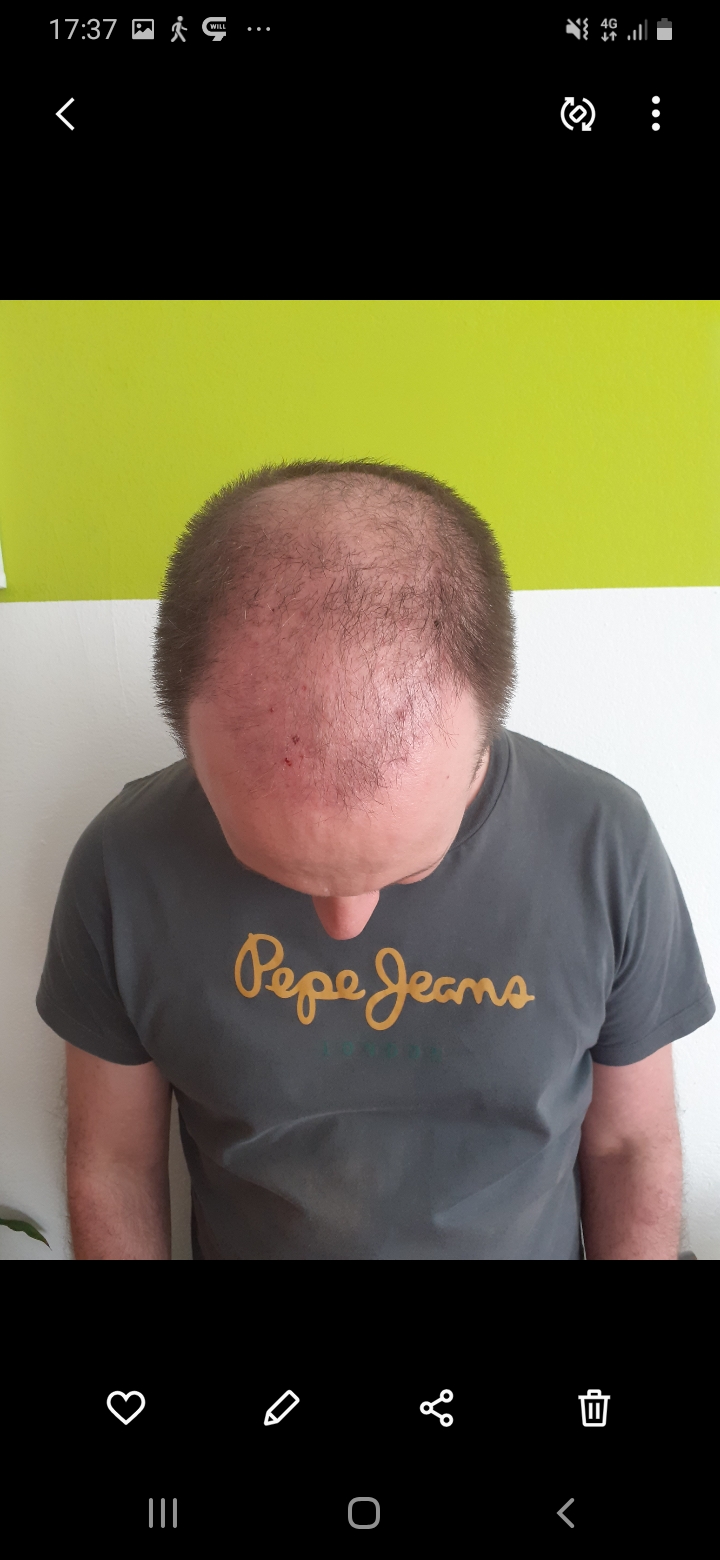 /foren/transplant/index.php/fa/56538/0/