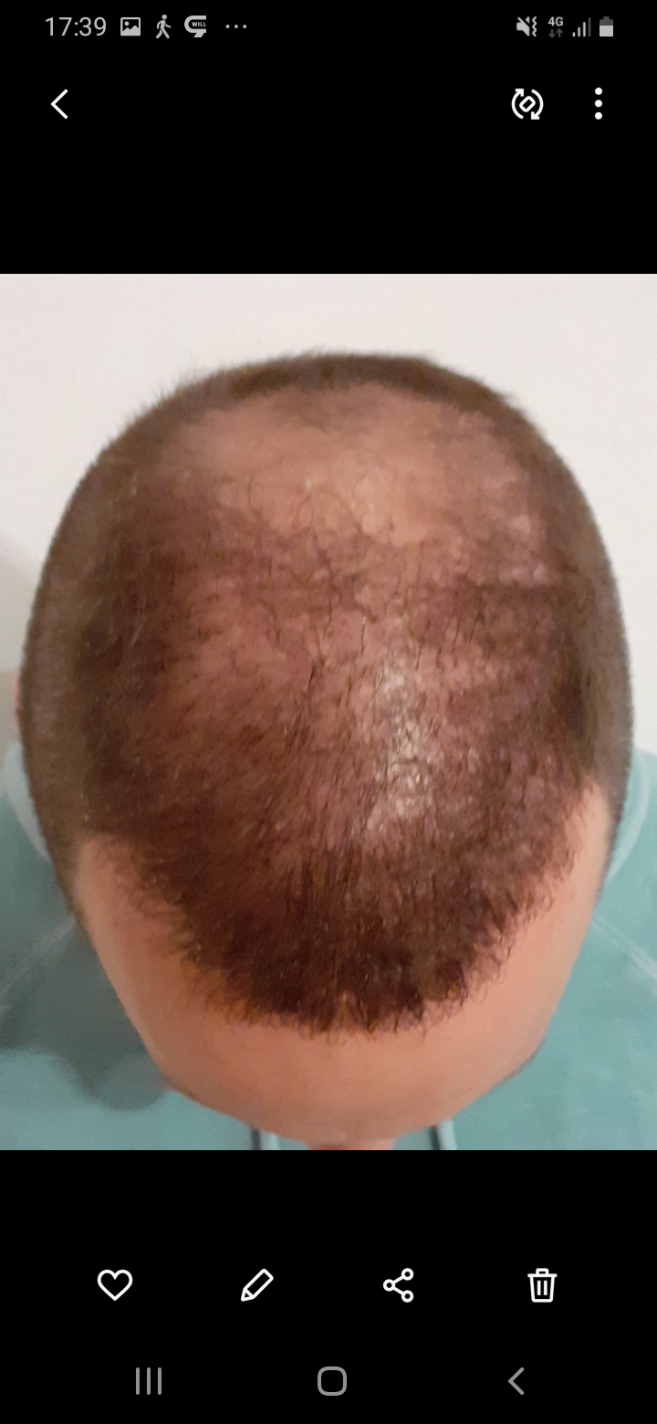 /foren/transplant/index.php/fa/56543/0/