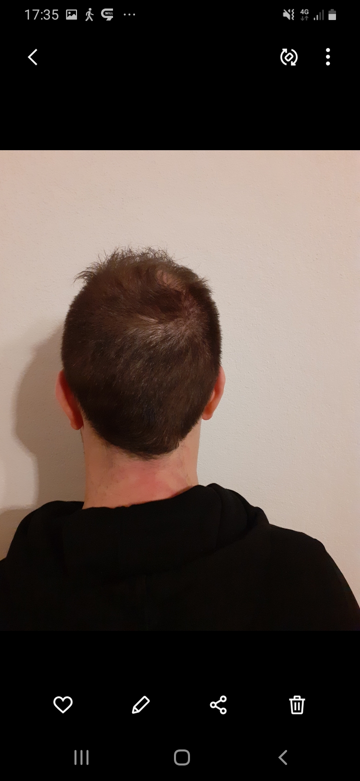 /foren/transplant/index.php/fa/56545/0/