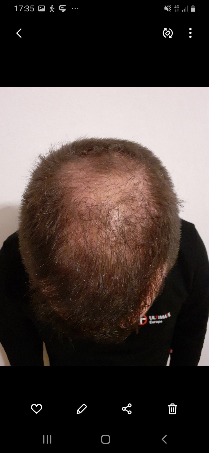 /foren/transplant/index.php/fa/56548/0/