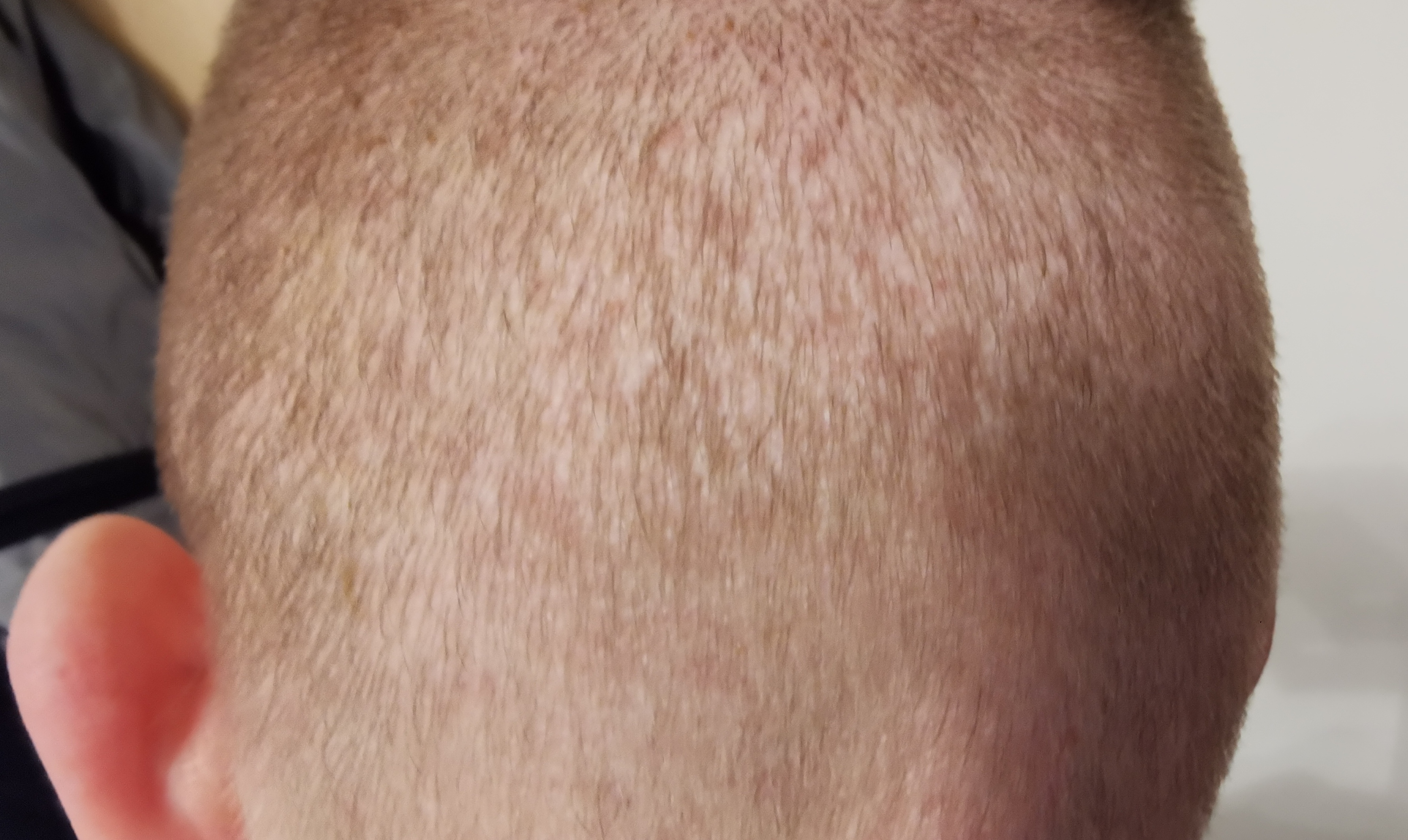 /foren/transplant/index.php/fa/56562/0/