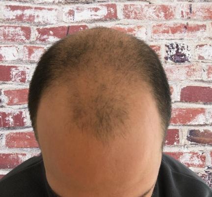 /foren/transplant/index.php/fa/56590/0/