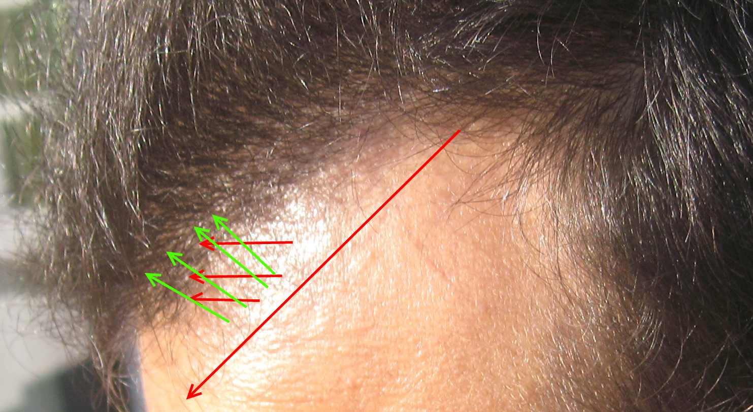 index.php/fa/5663/0/