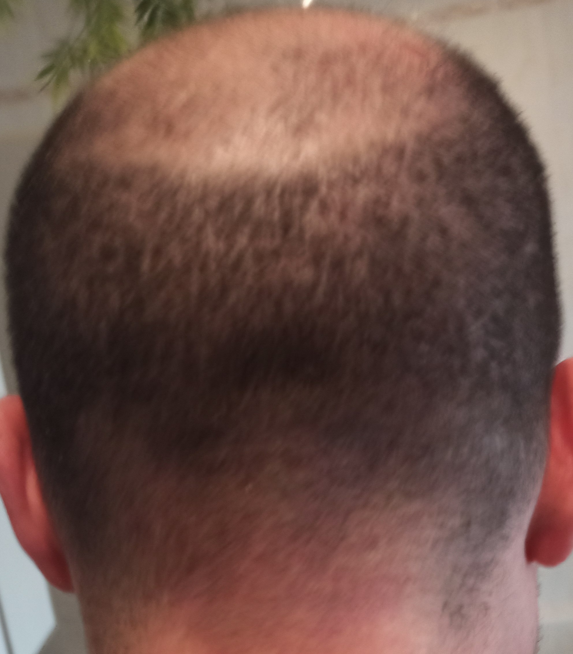 /foren/transplant/index.php/fa/56651/0/