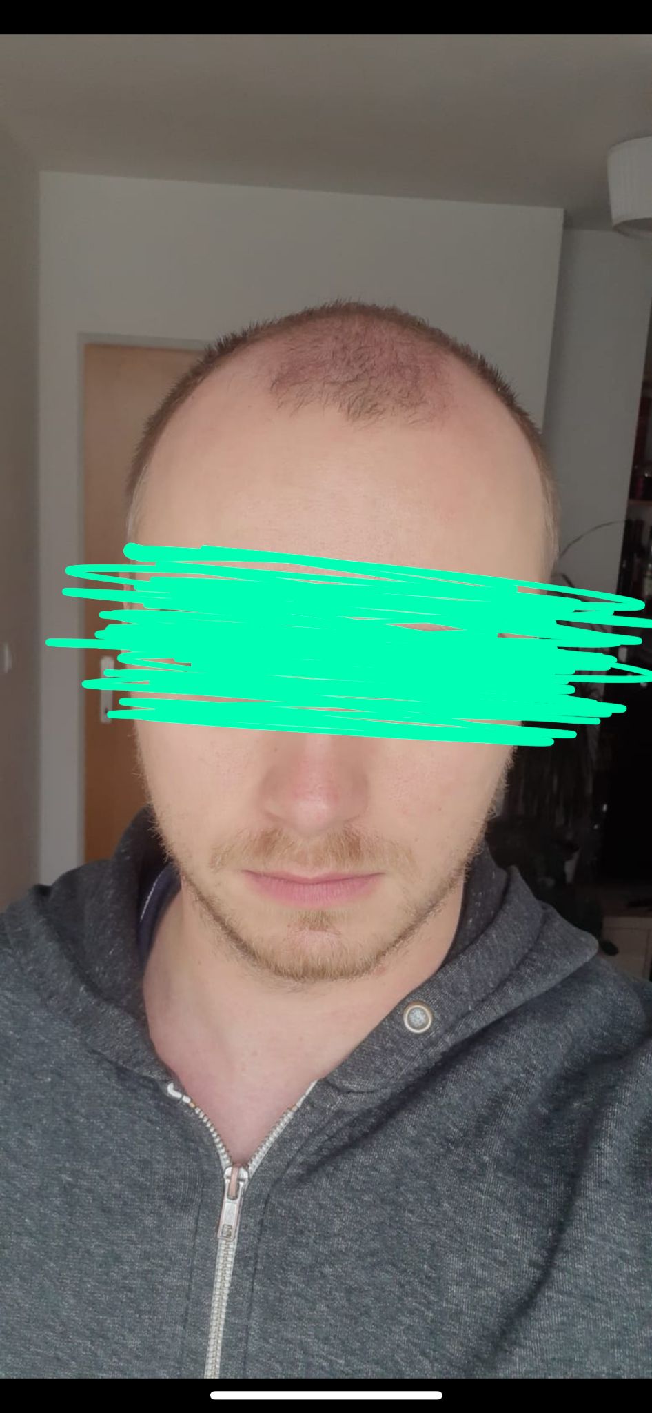 /foren/transplant/index.php/fa/56656/0/