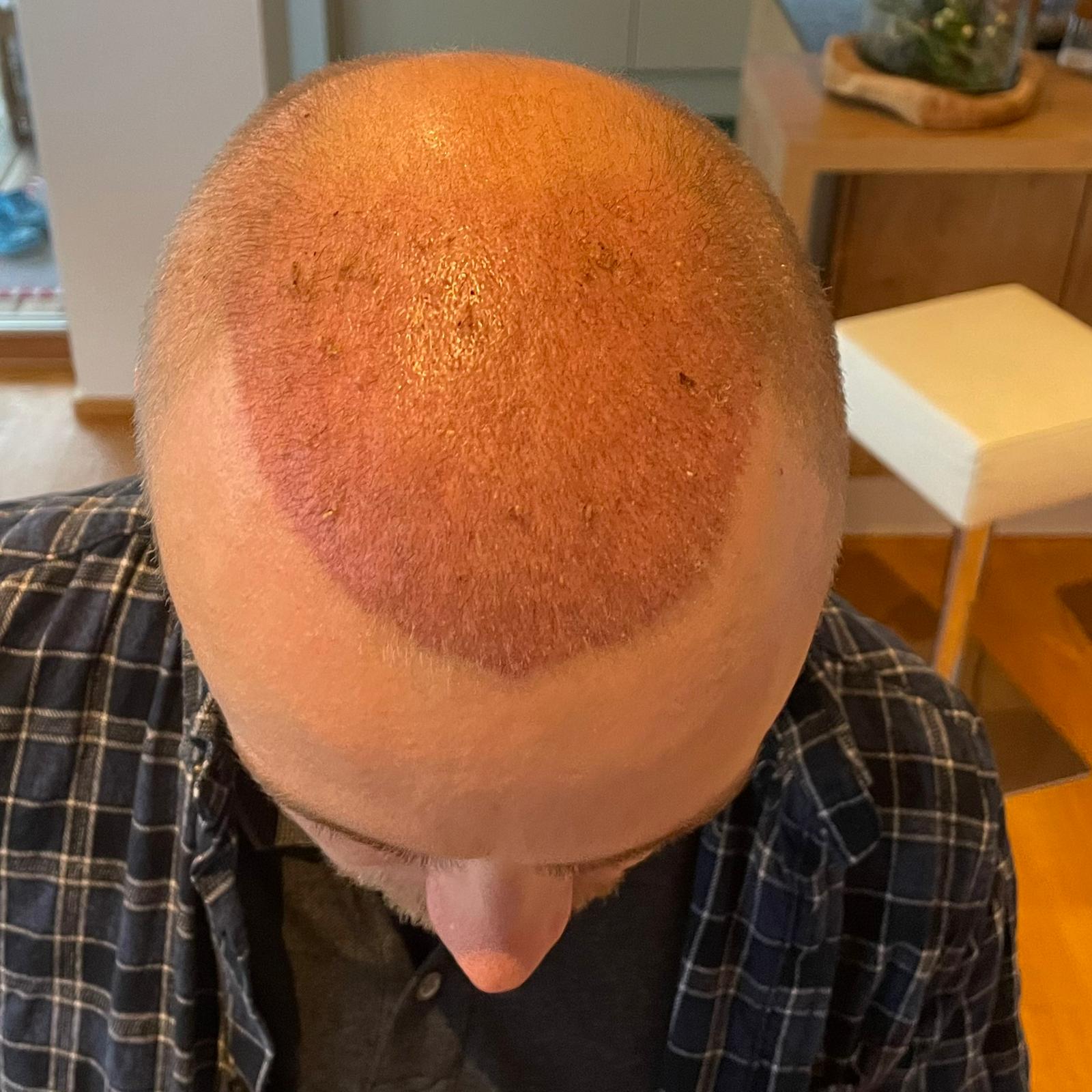 /foren/transplant/index.php/fa/56658/0/