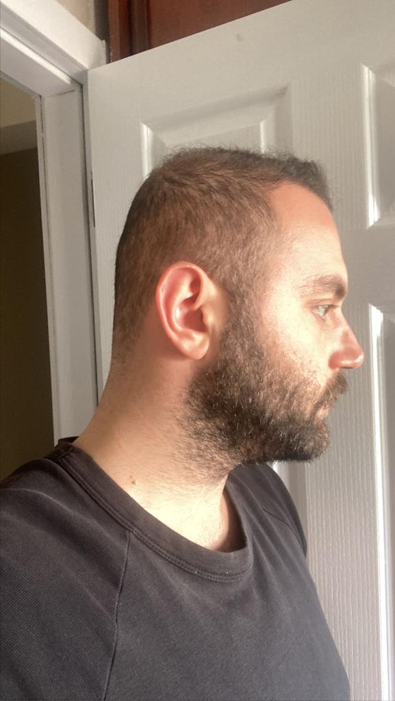 /foren/transplant/index.php/fa/56663/0/