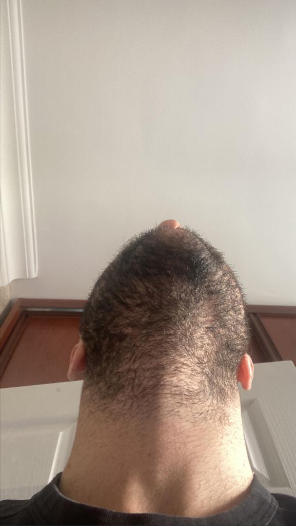 /foren/transplant/index.php/fa/56664/0/