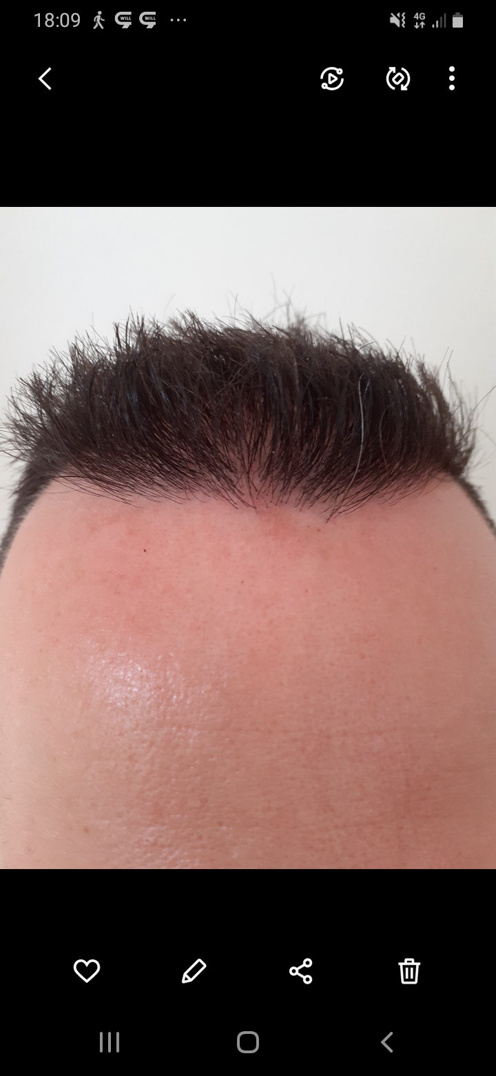 /foren/transplant/index.php/fa/56687/0/