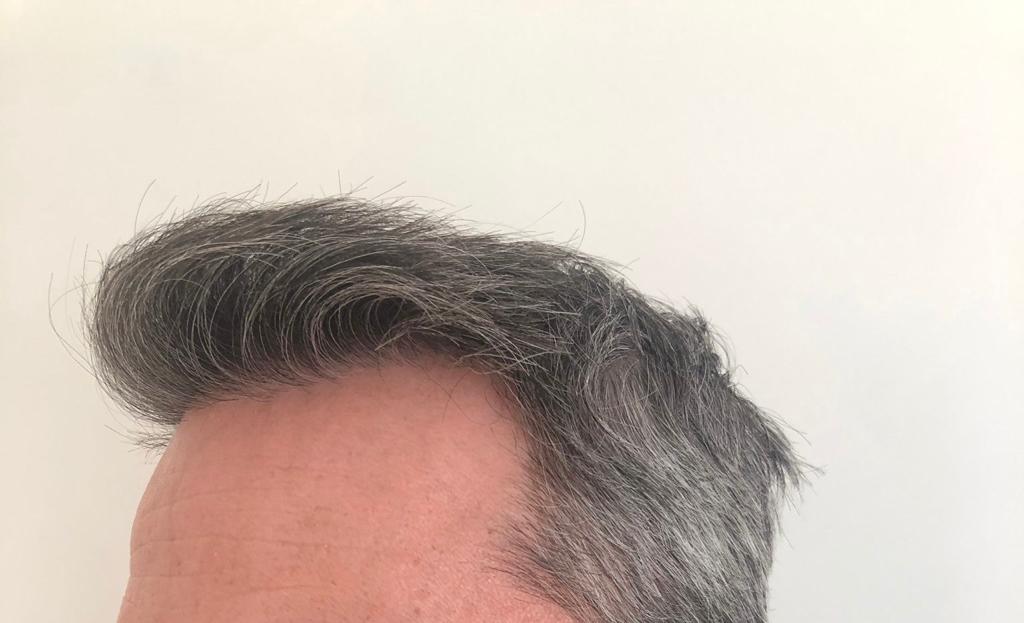 /foren/transplant/index.php/fa/56694/0/