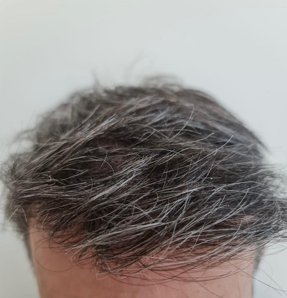 /foren/transplant/index.php/fa/56696/0/