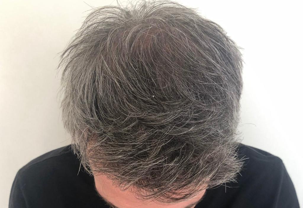 /foren/transplant/index.php/fa/56697/0/