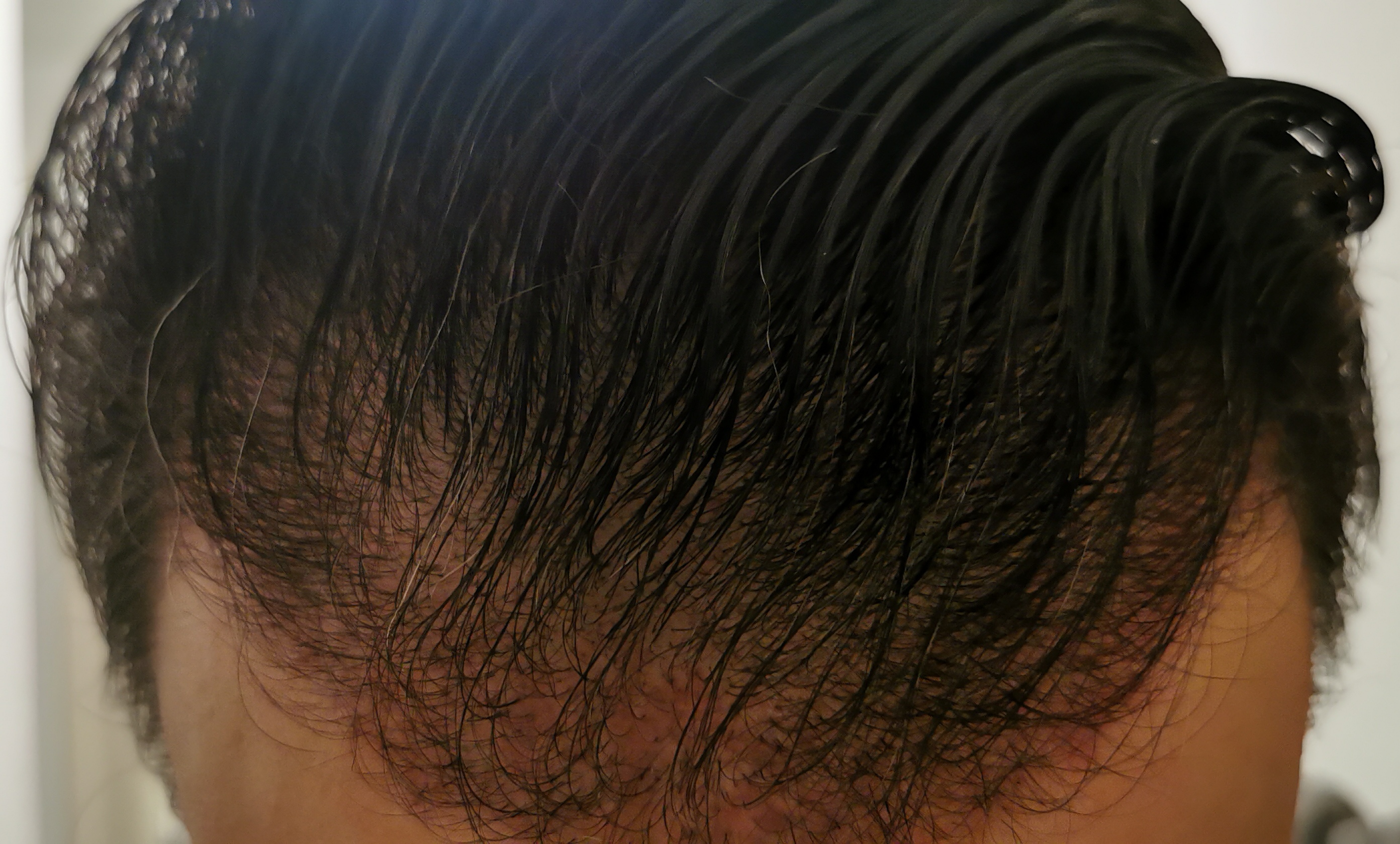 /foren/transplant/index.php/fa/56717/0/