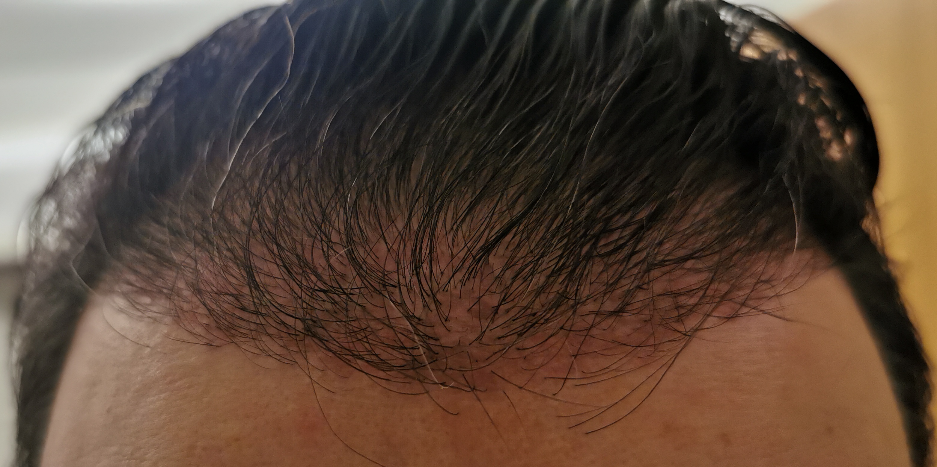 /foren/transplant/index.php/fa/56718/0/