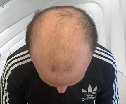 /foren/transplant/index.php/fa/56730/0/