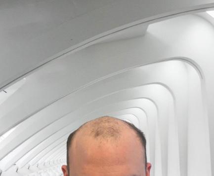 /foren/transplant/index.php/fa/56731/0/