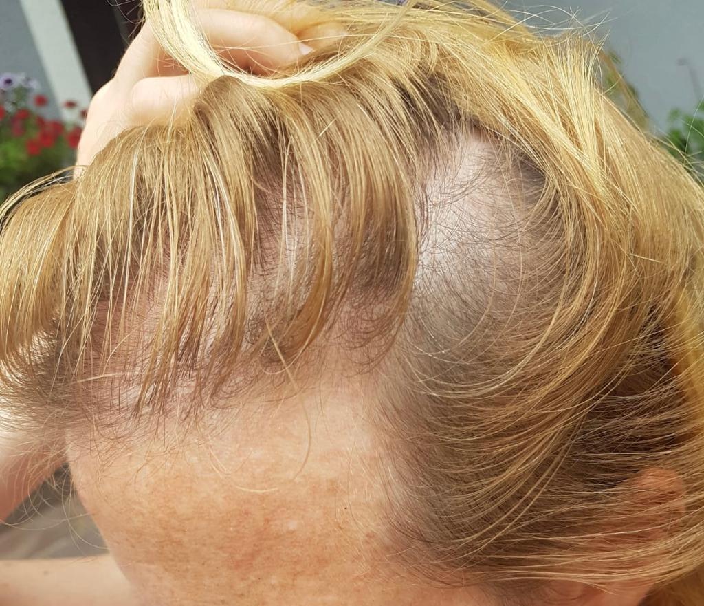 /foren/transplant/index.php/fa/56767/0/