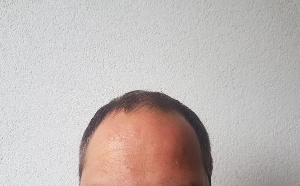 /foren/transplant/index.php/fa/56770/0/