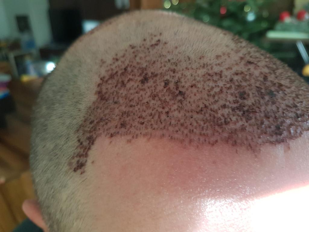 /foren/transplant/index.php/fa/56773/0/