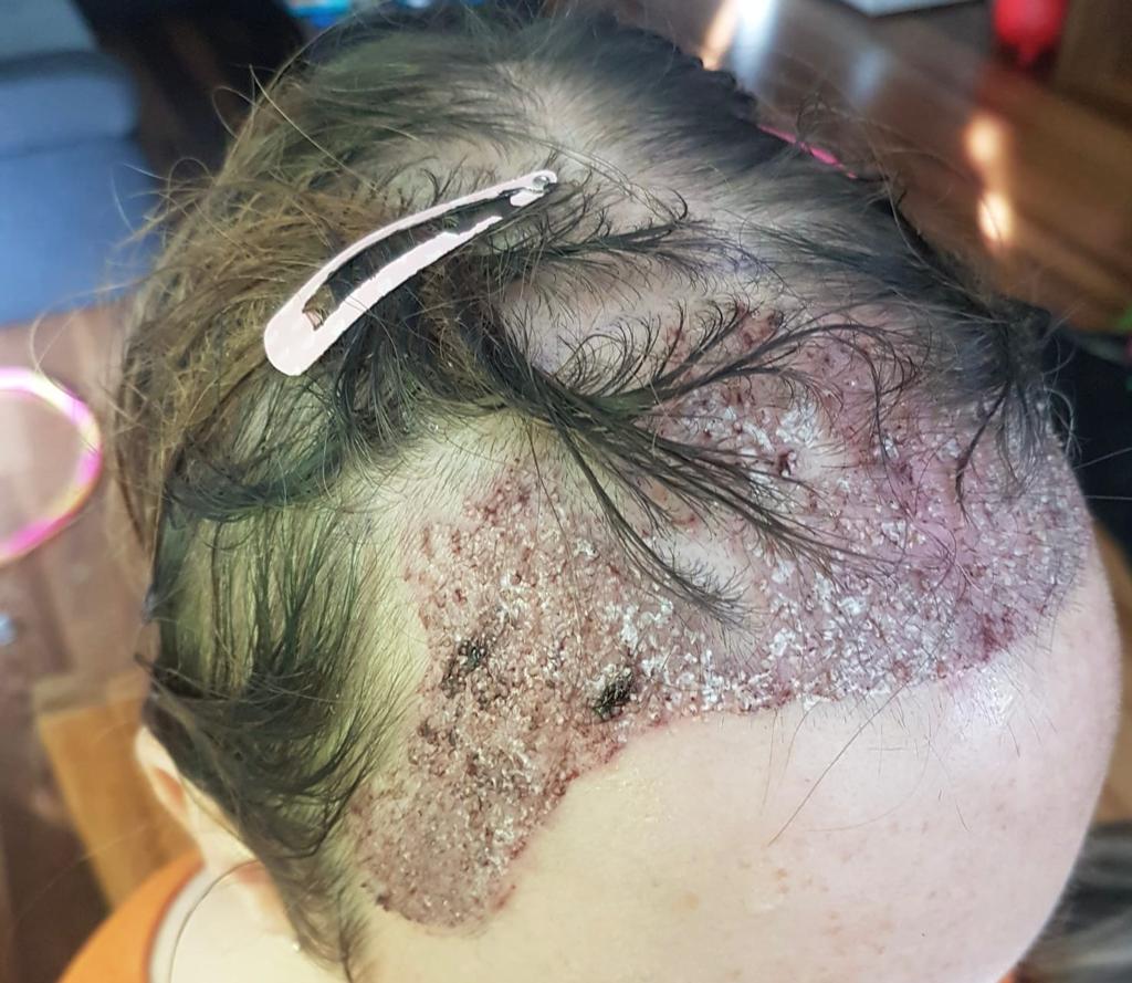 /foren/transplant/index.php/fa/56775/0/