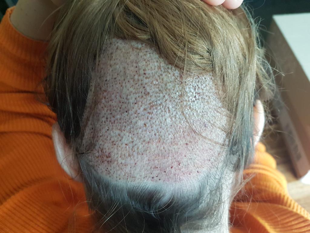 /foren/transplant/index.php/fa/56780/0/