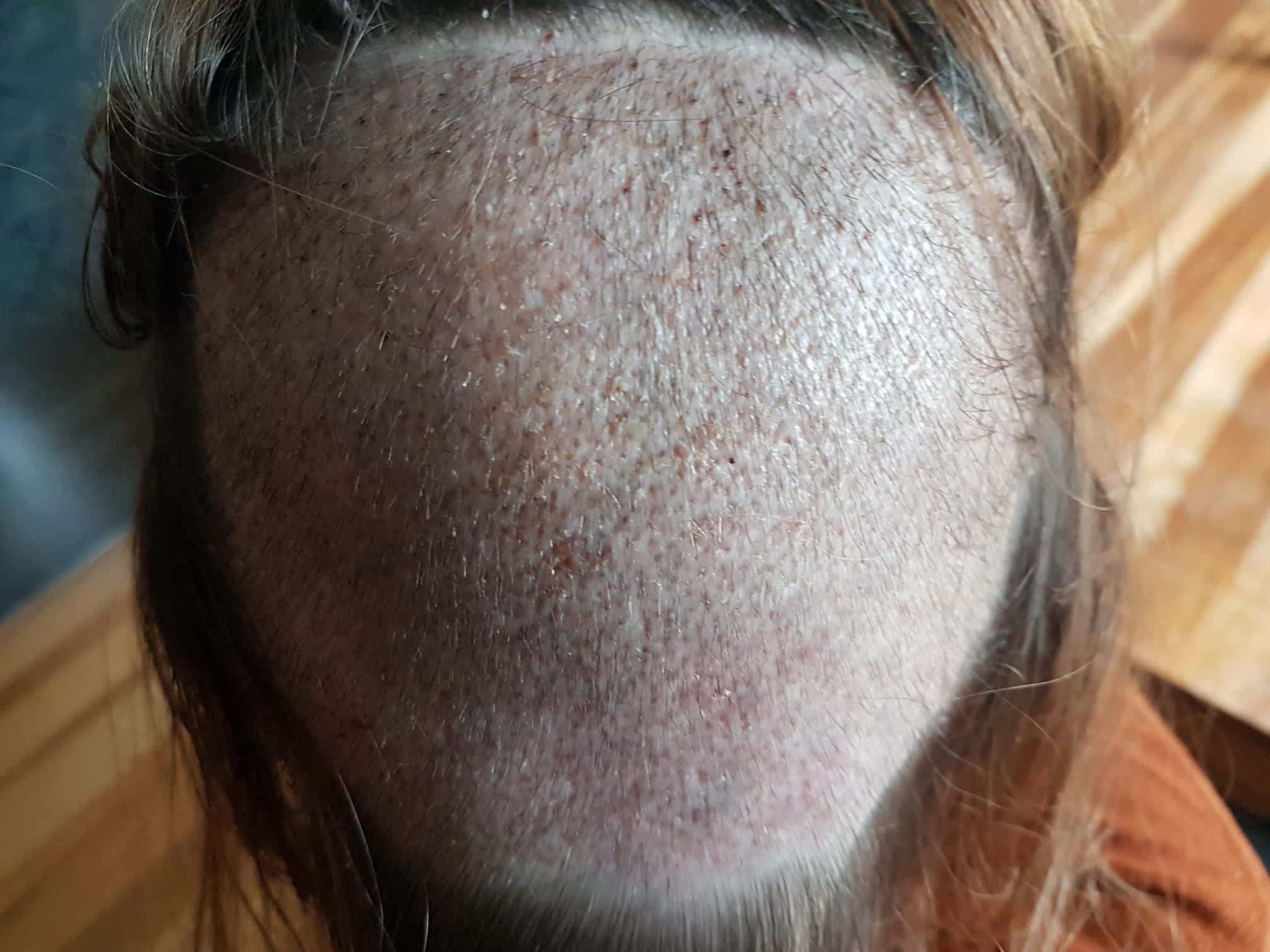 /foren/transplant/index.php/fa/56784/0/