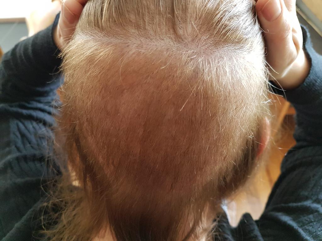 /foren/transplant/index.php/fa/56789/0/