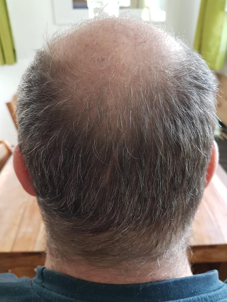 /foren/transplant/index.php/fa/56790/0/