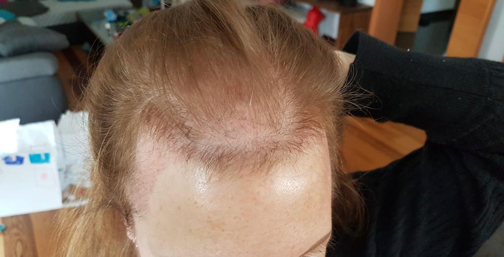 /foren/transplant/index.php/fa/56791/0/