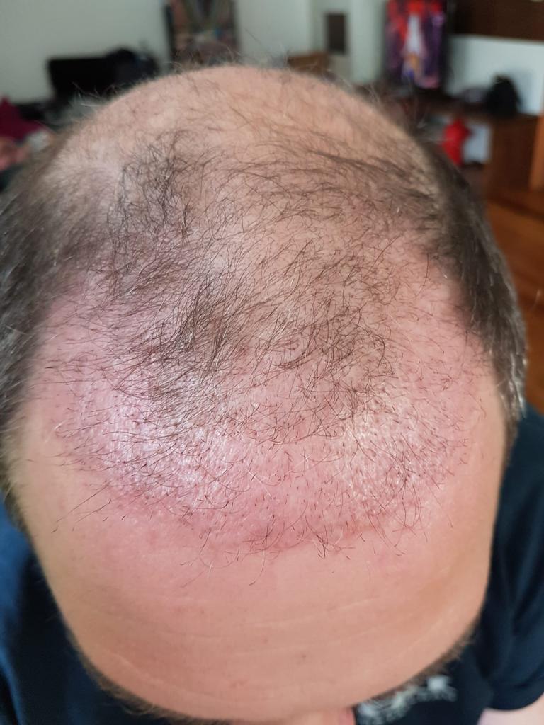 /foren/transplant/index.php/fa/56792/0/