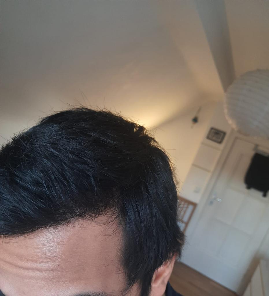 /foren/transplant/index.php/fa/56828/0/