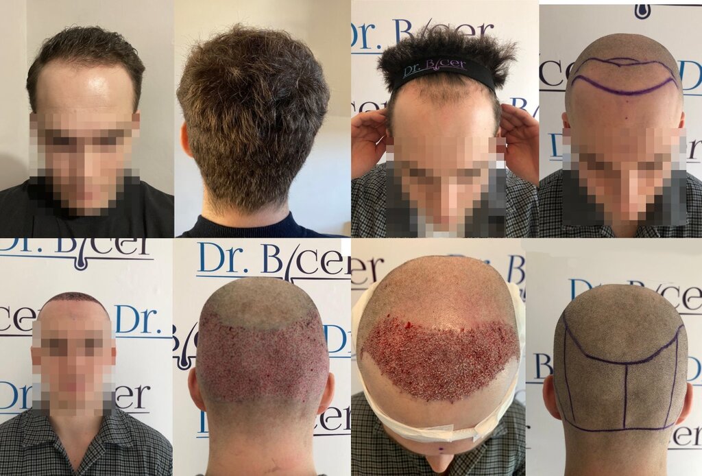 /foren/transplant/index.php/fa/56835/0/